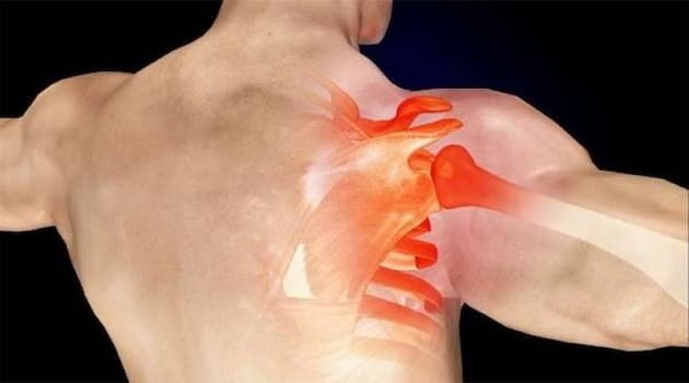 Omuz çıkığı belirtileri ve tedavisi nasıldır?